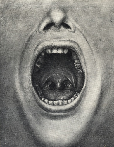 Illustration for article titled How an early psychiatric treatment lead to widespread mutilation